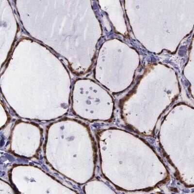 Immunohistochemistry-Paraffin: GMPR2 Antibody [NBP1-86183]