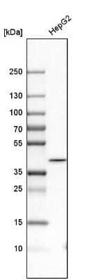 Western Blot: GMPR2 Antibody [NBP1-86183]