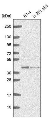 Western Blot: GMPR2 Antibody [NBP2-55842]