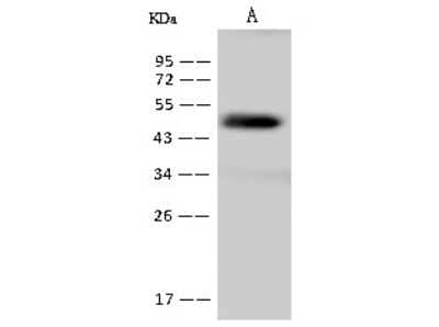 Western Blot: GMPR2 Antibody [NBP2-97734]