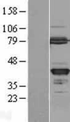 Western Blot: GMPR2 Overexpression Lysate [NBL1-11148]