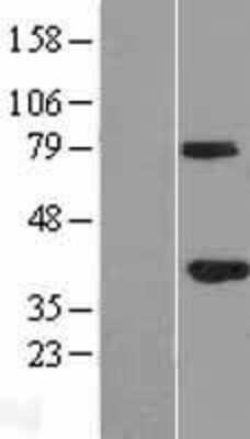 Western Blot: GMPR2 Overexpression Lysate [NBL1-11149]