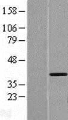 Western Blot: GMPR2 Overexpression Lysate [NBL1-11150]