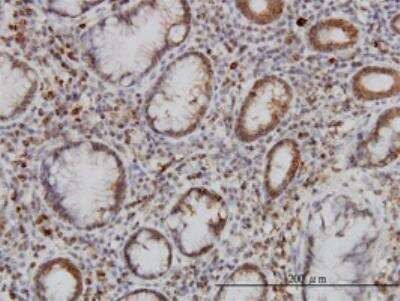 Immunohistochemistry-Paraffin: GMPS Antibody (1D10) [H00008833-M01]
