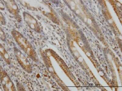 Immunohistochemistry-Paraffin: GMPS Antibody (1D10) [H00008833-M01]