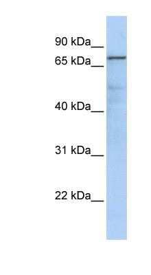 Western Blot: GMPS Antibody [NBP1-52972]