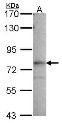 Western Blot: GMPS Antibody [NBP2-16696]