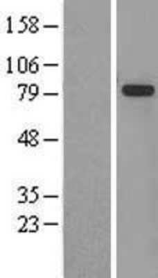 Western Blot: GMPS Overexpression Lysate [NBL1-11151]