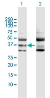 Western Blot: GNA11 Antibody [H00002767-D01P]