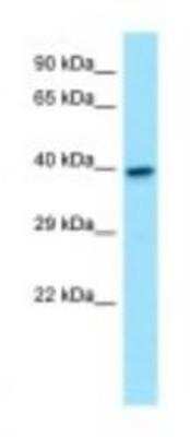 Western Blot: GNA11 Antibody [NBP1-98590]
