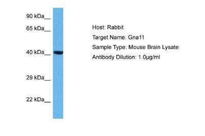 Western Blot: GNA11 Antibody [NBP1-98590]