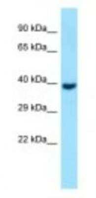 Western Blot: GNA11 Antibody [NBP1-98606]