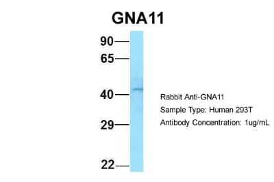 Western Blot: GNA11 Antibody [NBP1-98606]