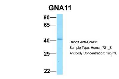 Western Blot: GNA11 Antibody [NBP1-98606]