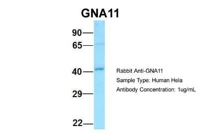 Western Blot: GNA11 Antibody [NBP1-98606]