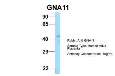Western Blot: GNA11 Antibody [NBP1-98606]
