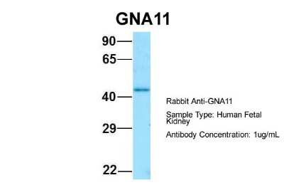 Western Blot: GNA11 Antibody [NBP1-98606]