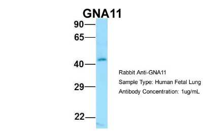 Western Blot: GNA11 Antibody [NBP1-98606]