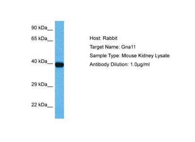 Western Blot: GNA11 Antibody [NBP1-98606]