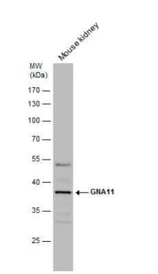 Western Blot: GNA11 Antibody [NBP2-16697]