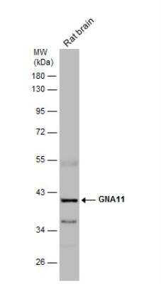 Western Blot: GNA11 Antibody [NBP2-16697]