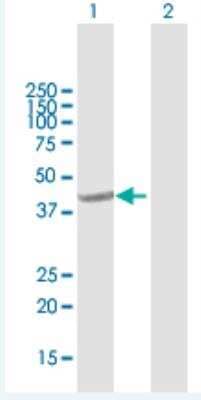 Western Blot: GNA14 Antibody [H00009630-B01P-50ug]