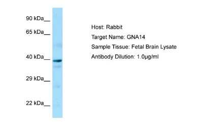 Western Blot: GNA14 Antibody [NBP1-98546]