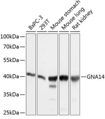 Western Blot: GNA14 AntibodyBSA Free [NBP3-05016]