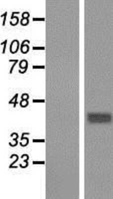 Western Blot: GNA14 Overexpression Lysate [NBP2-07884]