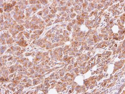Immunohistochemistry-Paraffin: GNAI3 Antibody [NBP1-32617]