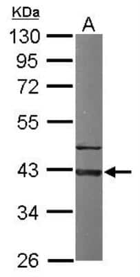 Western Blot: GNAI3 Antibody [NBP1-32617]