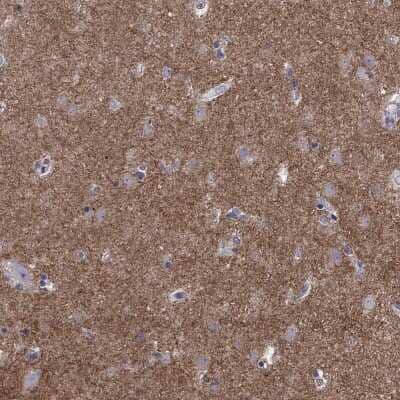 Immunohistochemistry: GNAL Antibody [NBP2-68695]