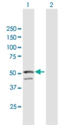 Western Blot: GNAL Antibody [H00002774-B02P]