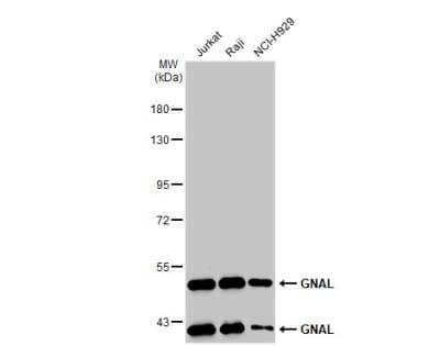 Western Blot: GNAL Antibody [NBP1-32225]