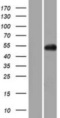 Western Blot: GNAL Overexpression Lysate [NBP2-04792]