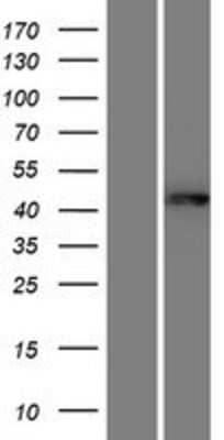 Western Blot: GNAL Overexpression Lysate [NBP2-09634]