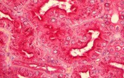 Immunohistochemistry-Paraffin: GNAQ Antibody [NBP1-72047]