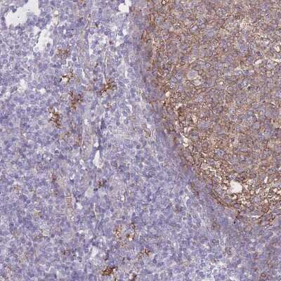 Immunohistochemistry-Paraffin: GNA11 Antibody [NBP2-54735]