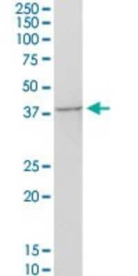 Western Blot: GNAQ Antibody [H00002776-B01P]