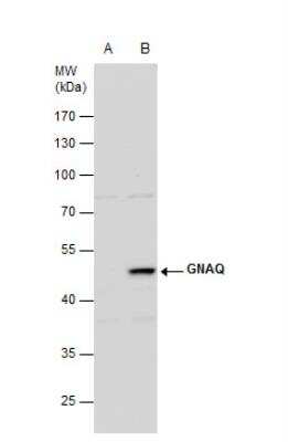 Western Blot: GNAQ Antibody [NBP1-31985]