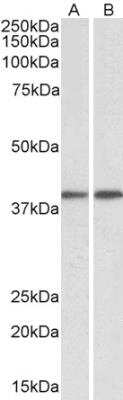 Western Blot: GNAQ Antibody [NBP1-72047]