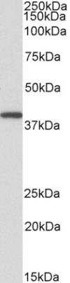 Western Blot: GNAQ Antibody [NBP1-72047]