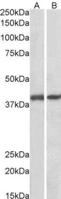 Western Blot: GNAQ Antibody [NBP1-72047]