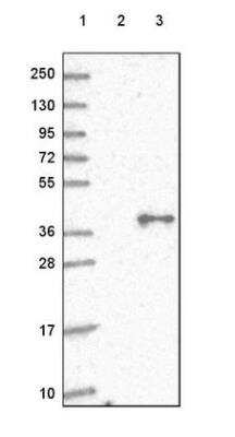 Western Blot: GNA11 Antibody [NBP2-54735]