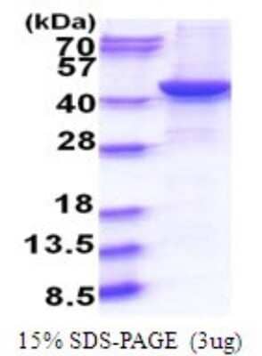 SDS-PAGE: Recombinant Human GNAQ His Protein [NBP2-51808]