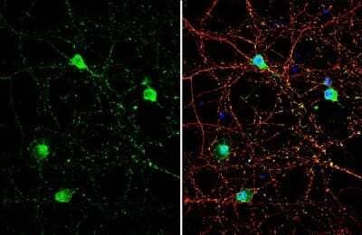 Immunocytochemistry/ Immunofluorescence: GNAT2 Antibody [NBP3-13378]