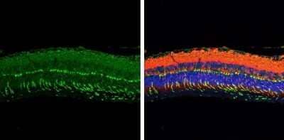 Immunohistochemistry-Paraffin: GNAT2 Antibody [NBP3-13378]
