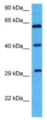 Western Blot: GNAT2 Antibody [NBP3-10037]