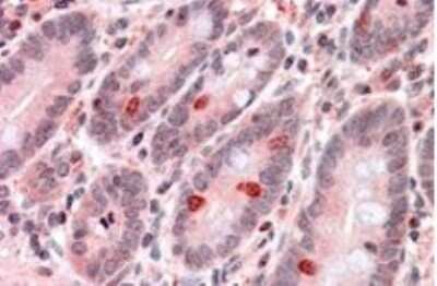 Immunohistochemistry-Paraffin: GNAT3 Antibody [NBP1-20926]