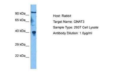 Western Blot: GNAT3 Antibody [NBP2-84050]